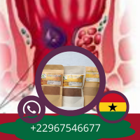 Hemorrhoid natural treatment in ghana 1 