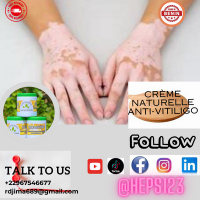 Natural anti vitiligo cream in cameroon 1 