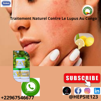 Traitement naturel contre le lupus au congo